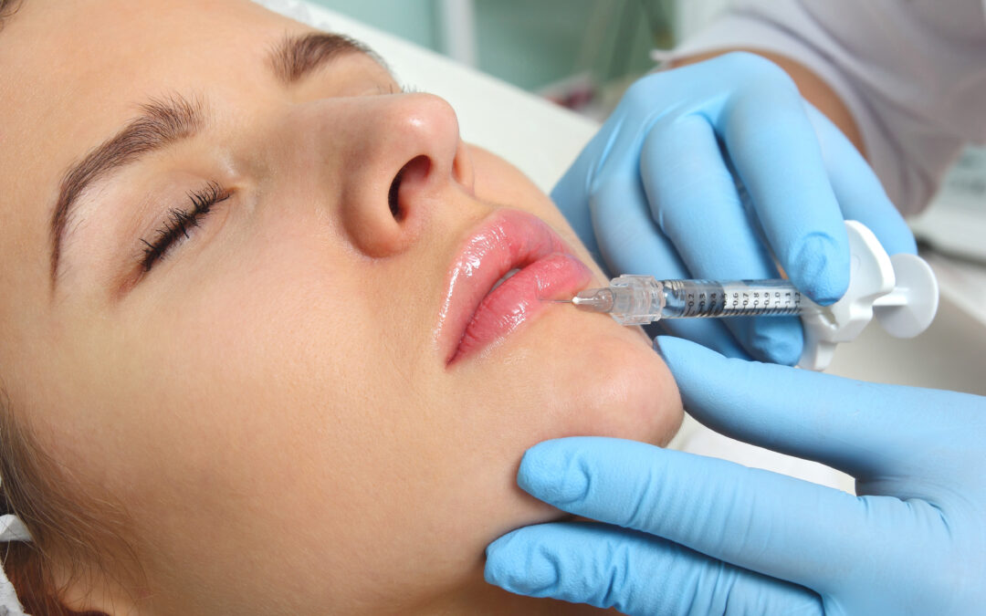 Fillers riassorbibili