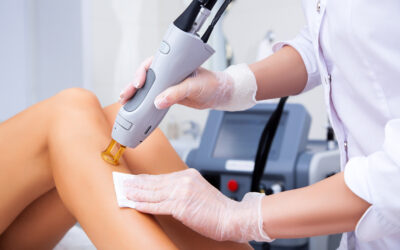 Depilazione laser