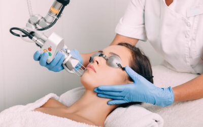 Come eliminare le imperfezioni della pelle con i laser chirurgici