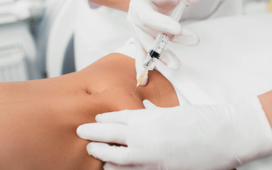 Liposcultura non chirurgica (Intralipoterapia)