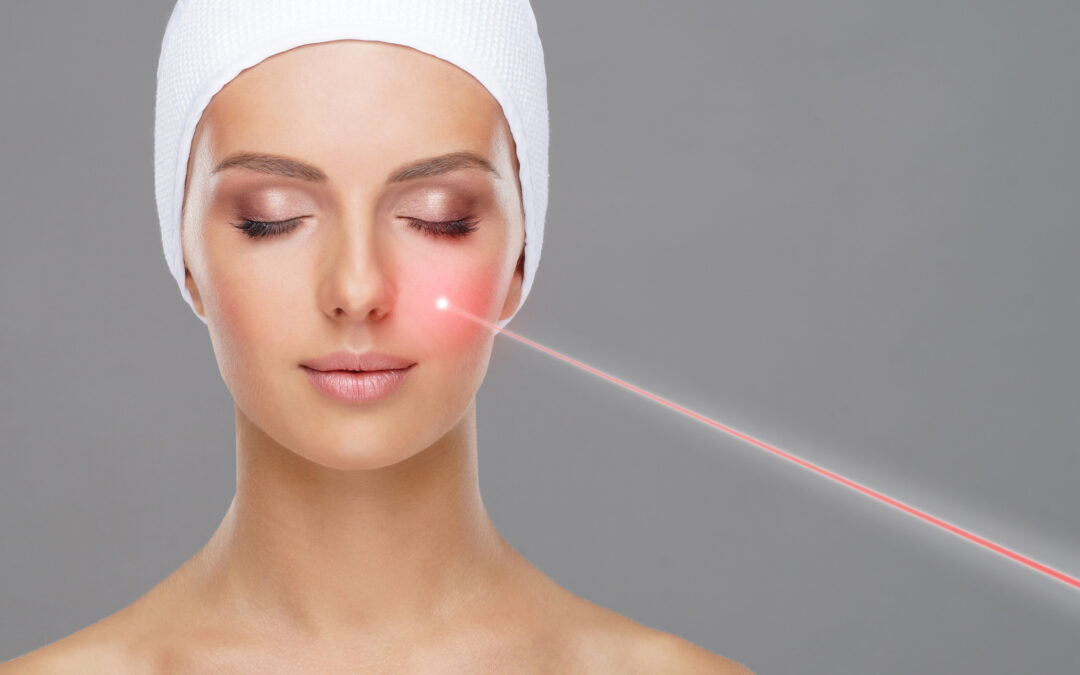 Rughe, Ringiovanimento cutaneo, Laser Skin Resurfacing