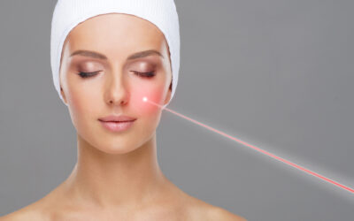 Luce pulsata ad alta intensità: una soluzione efficace per l’acne rosacea