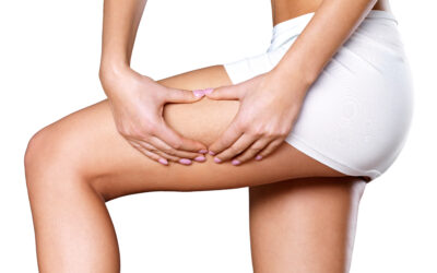 La fosfatidilcolina: un alleato naturale contro la cellulite e il grasso localizzato