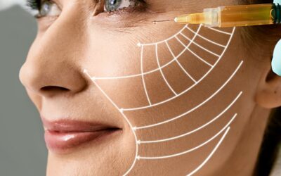 Profhilo®: il trattamento rivoluzionario per ringiovanire il viso in modo naturale e duraturo