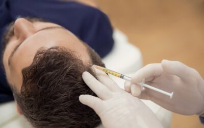 Trattamento PRP: una soluzione innovativa per l’alopecia